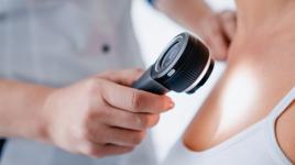 Je jí 25 let a má rakovinu kůže. „Prevenci nepodceňujte,“ apeluje na ostatní