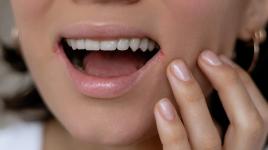 Babské rady na popraskané koutky: pomáhá droždí s olivovým olejem, med nebo odvar z bylinek