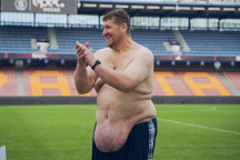 Extrémní proměny, Lukáš Skupin
