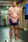 Extrémní proměny, Lukáš Skupin