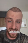 Martin Prágr, vlasy