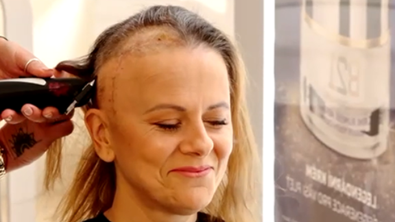 Laďka Něrgešová šla s kůží na trh: Ukázala obří jizvu po náročné operaci mozku!